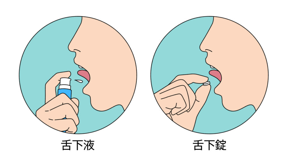 舌下免疫療法とは